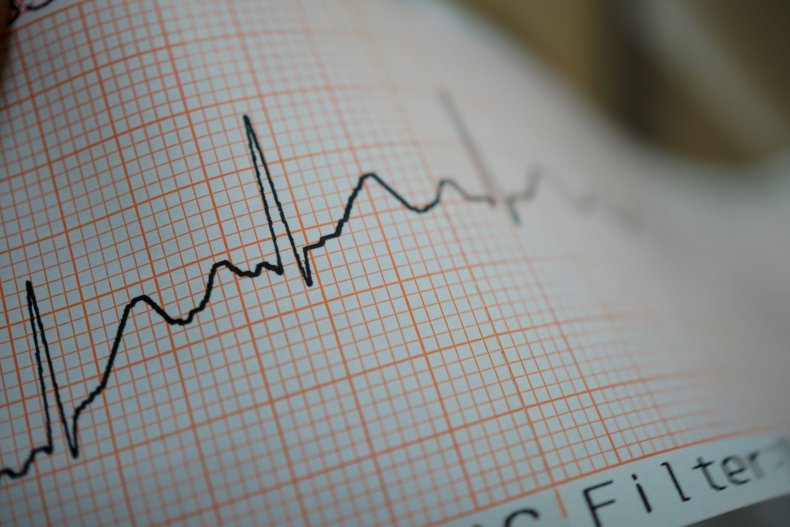 7_9_ECG