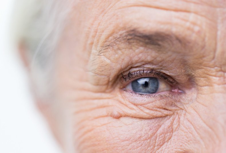 aging-wrinkles-old-grey-hair-stock