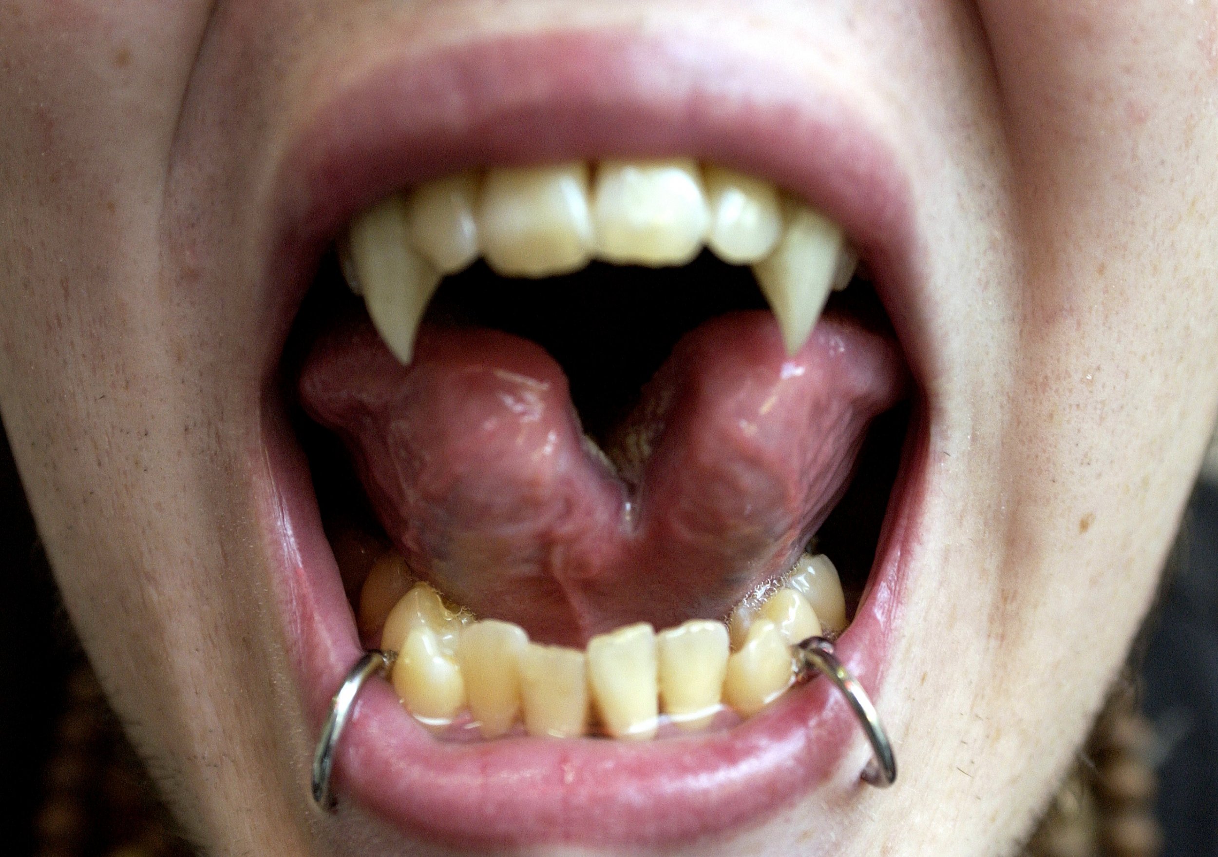 What Is Tongue-splitting? 