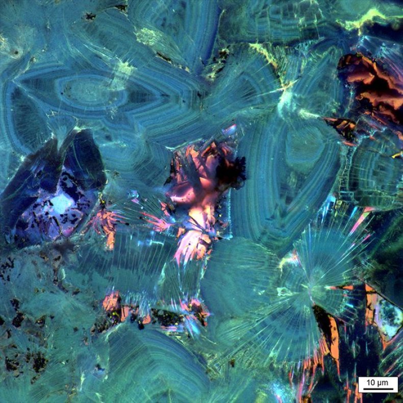 kidneystones3