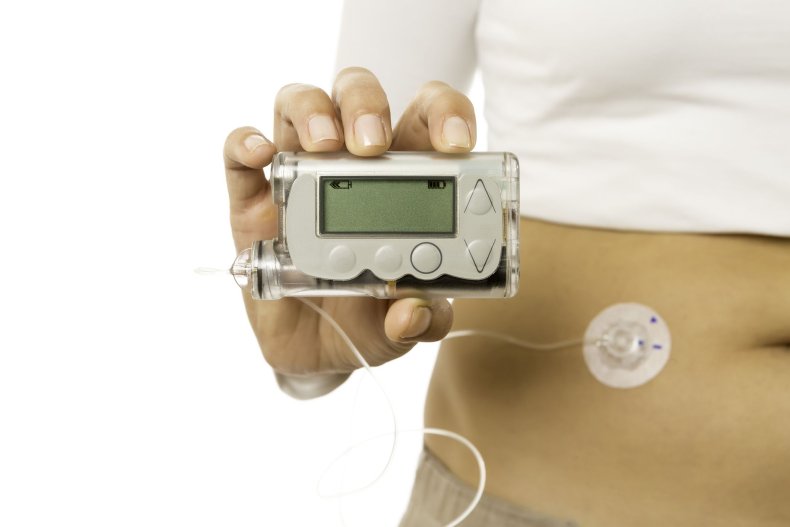 9_14_Insulin pump 9_14_Insulin pump