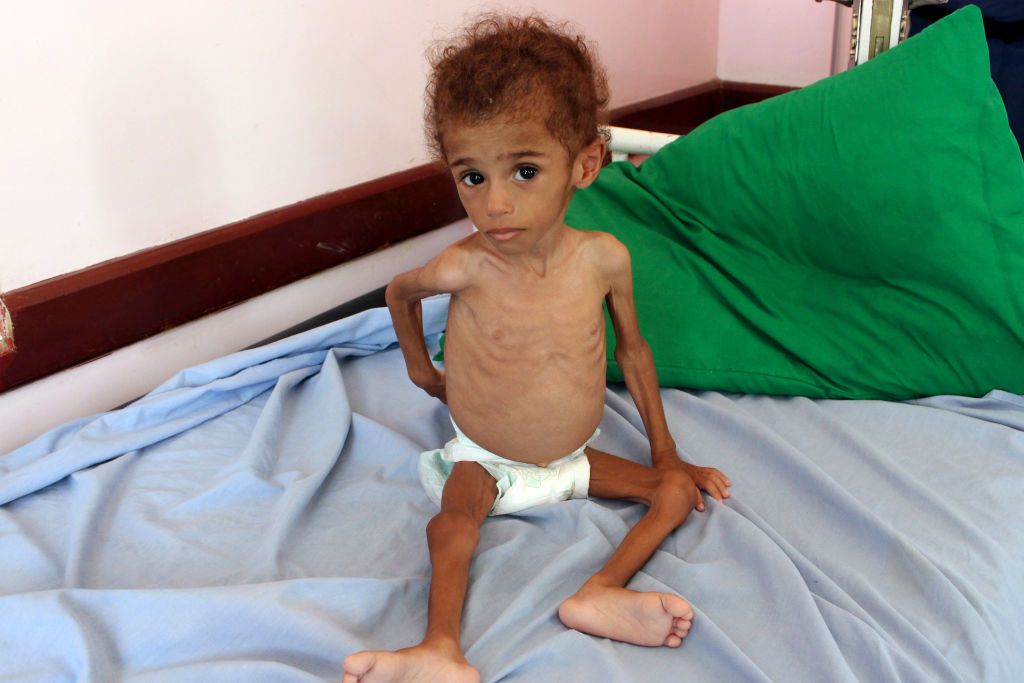 'Worst Famine in 100 Years' Could See 13 Million People Starve if Saudi ...