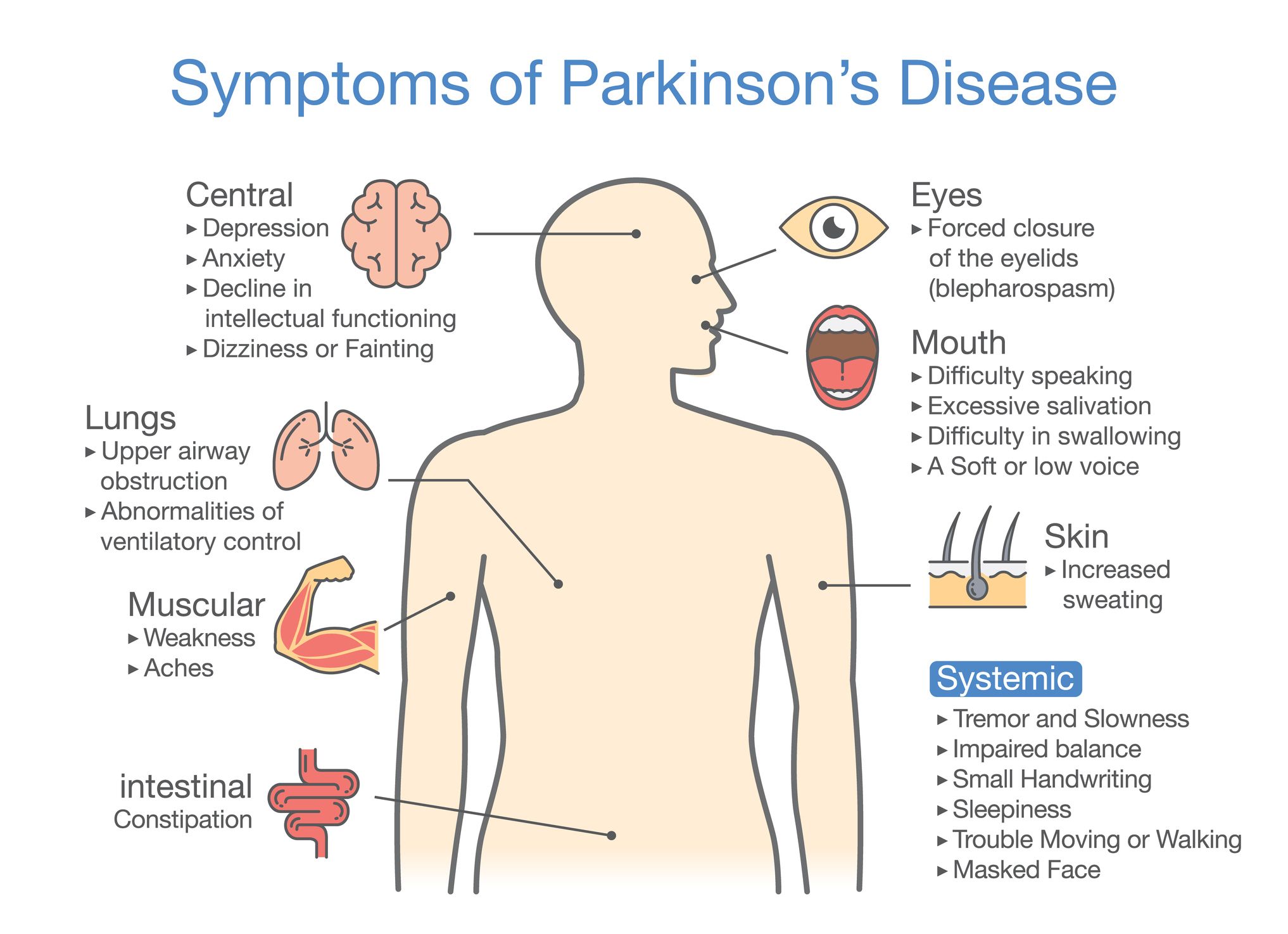 Appendix Removal Linked To 20 Drop In Parkinson S Disease Risk   Parkinsons Symptoms 