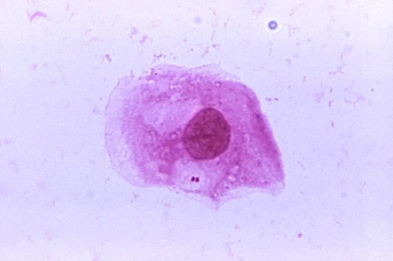 phil-2678-mening