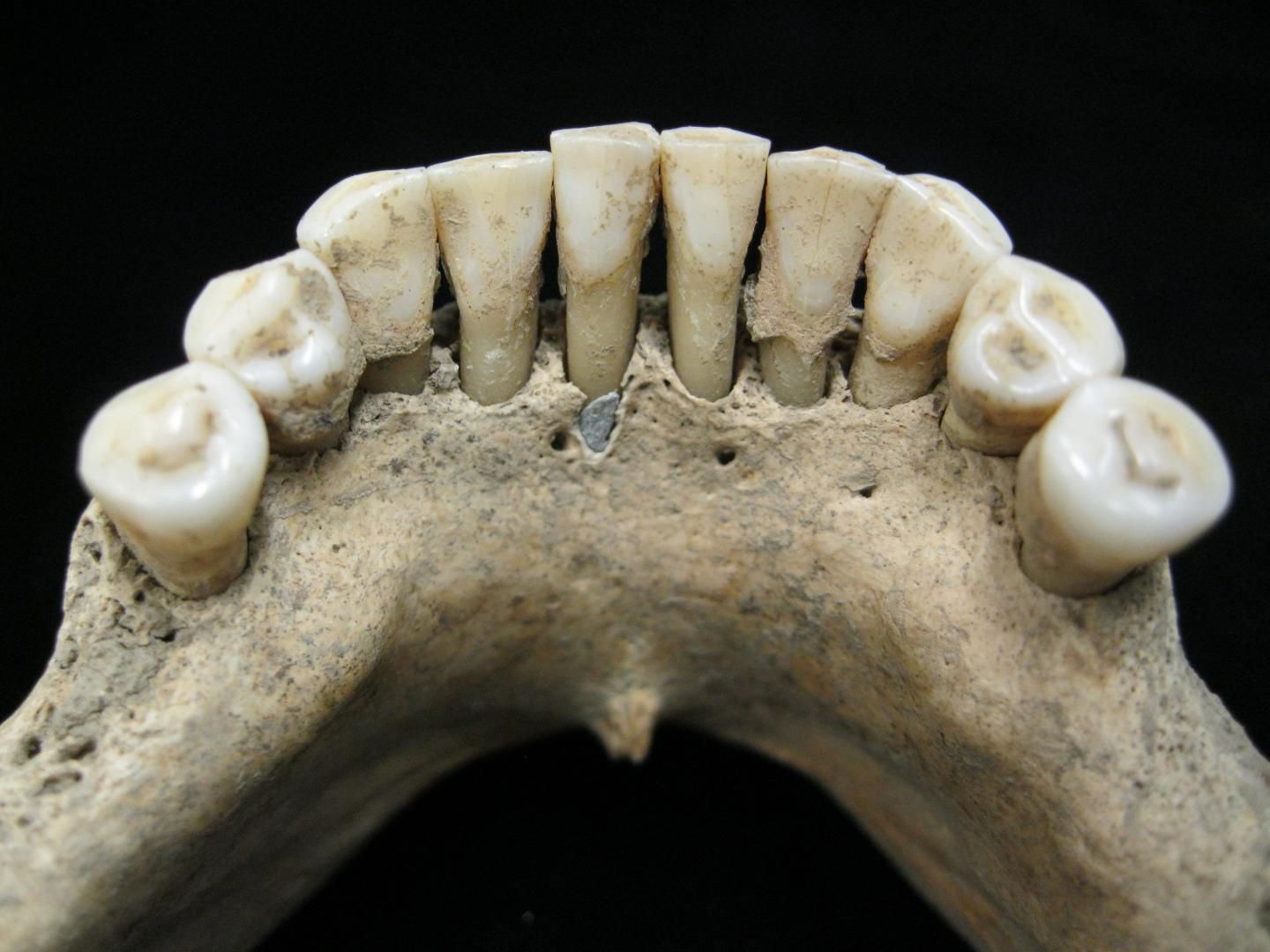 medieval teeth