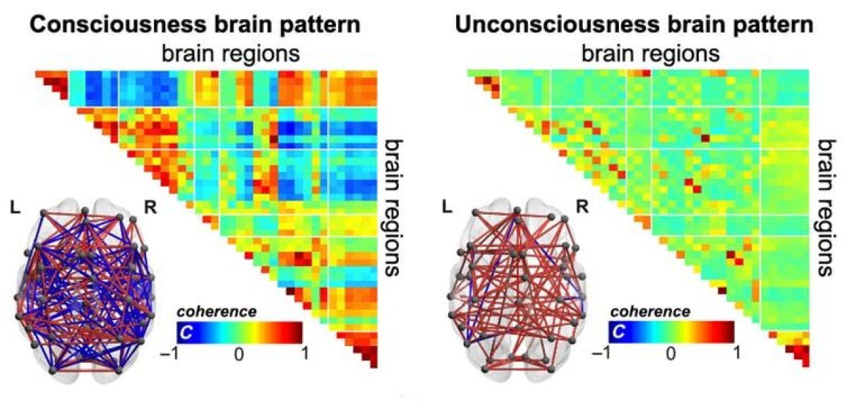 brain consciousness