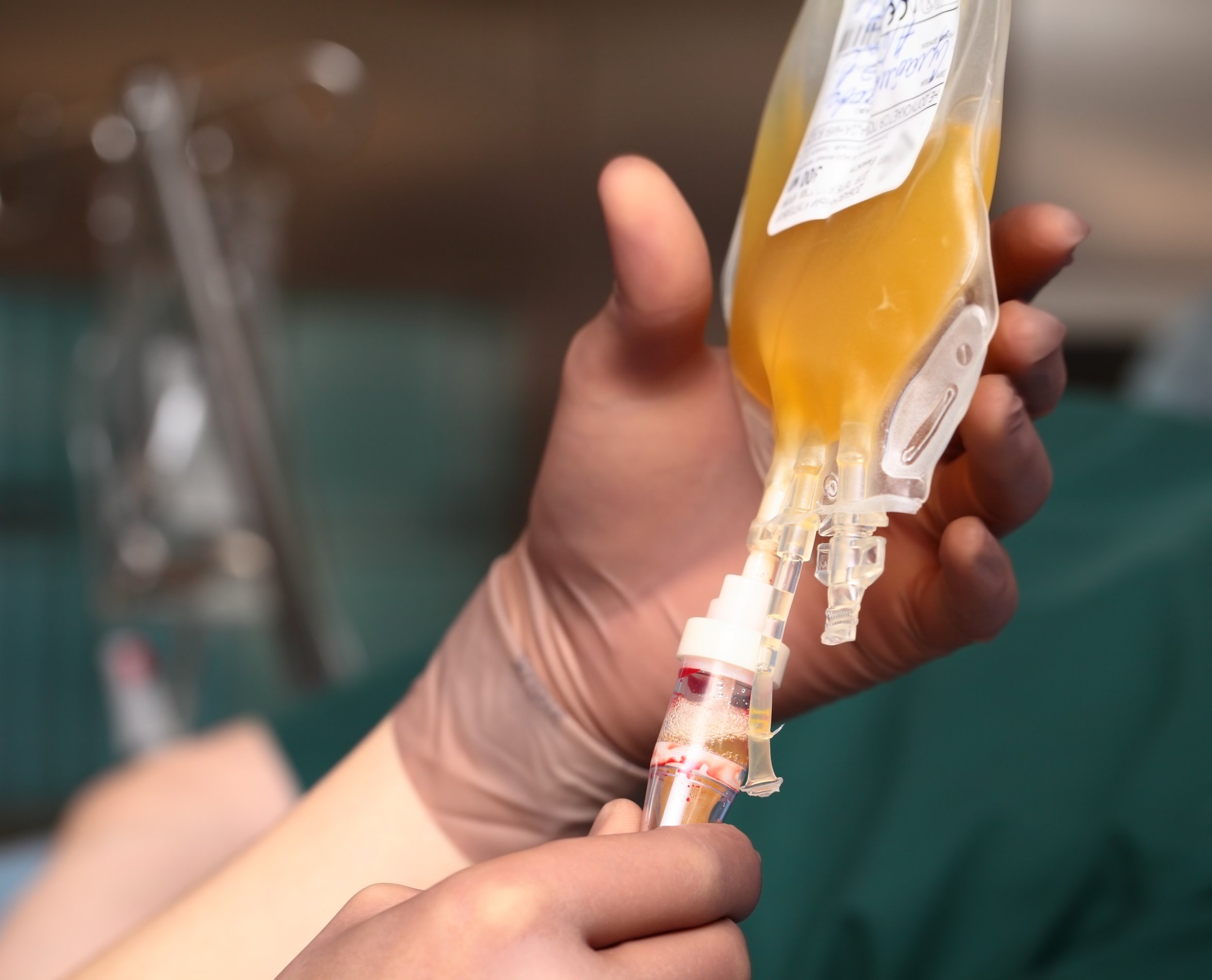 FDA Warns Against Blood Transfusions From Young Donors as Anti-Aging