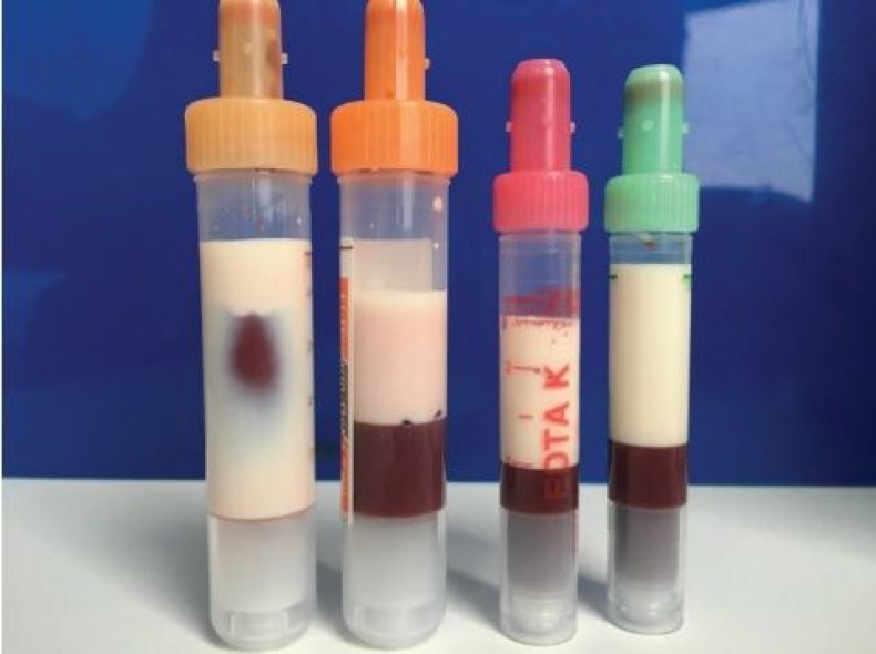 Blood milk color