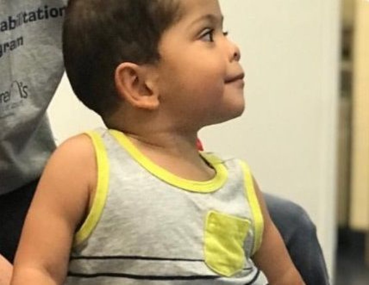 Thieves Steal 3-year-old's Minion-decorated Prosthetic Leg - Newsweek