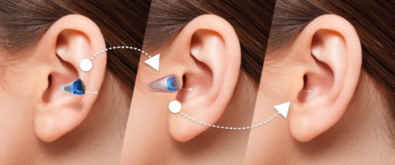 Hearing Aid 1