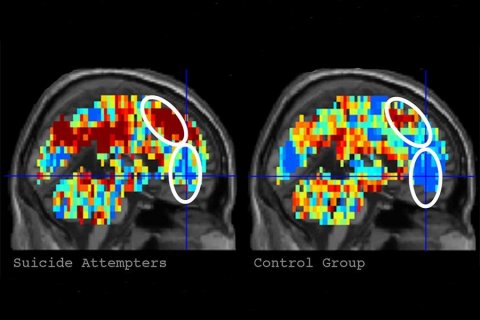 Researchers at Carnegie Mellon identified people with suicidal tendencies