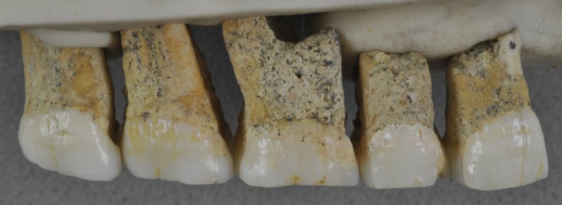 Homo luzonensis teeth