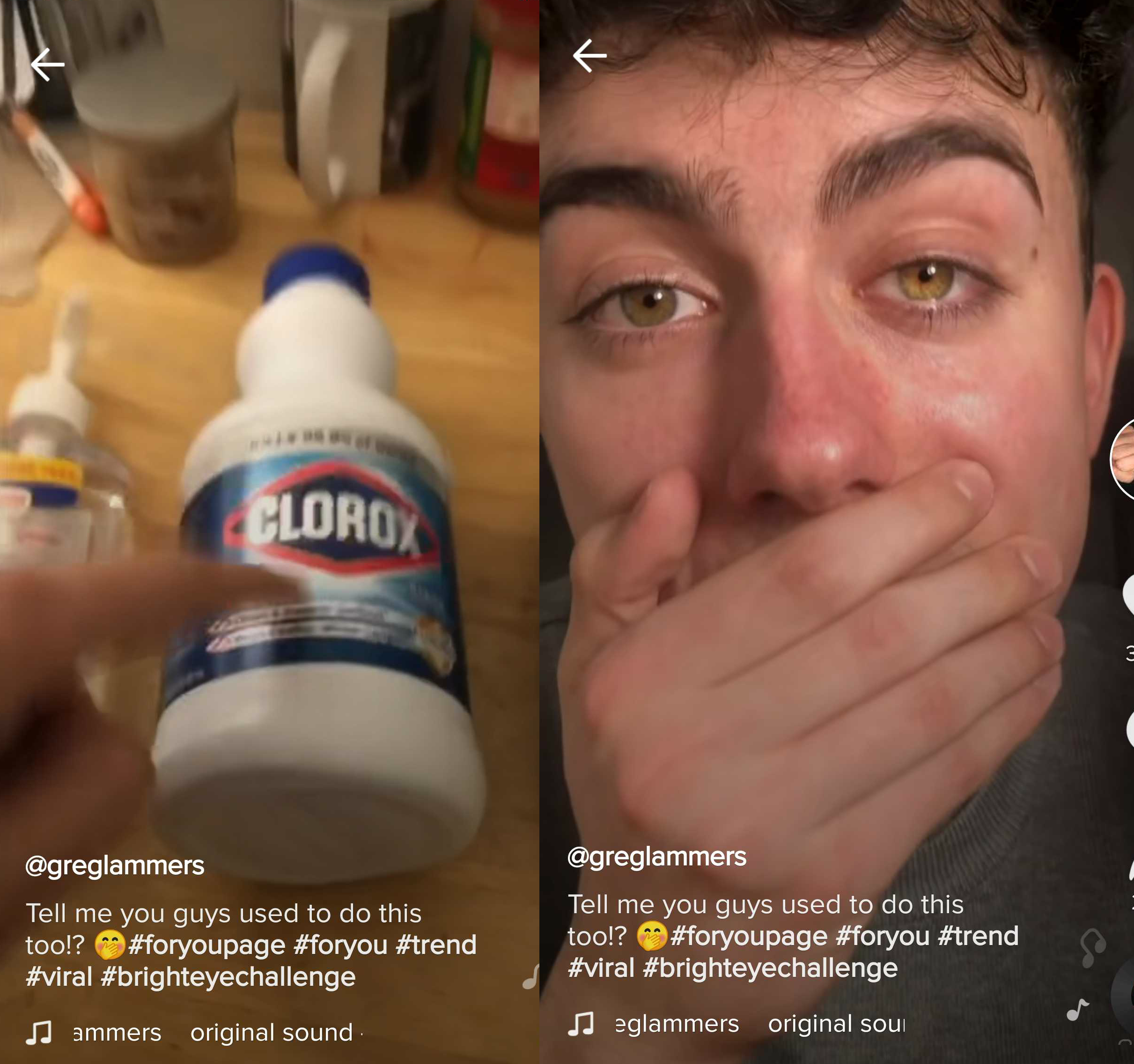 New Tiktok Challenge Asks Users To Place Bag Of Bleach Near Eye