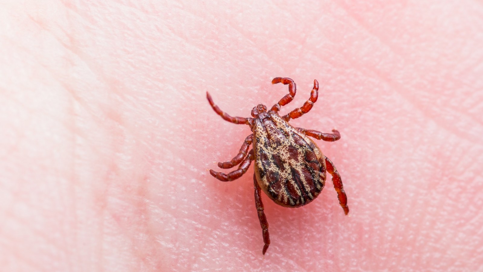 Untreatable Form Of Lyme Disease Could Hit 2 Million Americans By 2020 Scientists Warn Untreatable Form Of Lyme Disease Could Hit 2 Million Americans By 2020 Scientists Warn