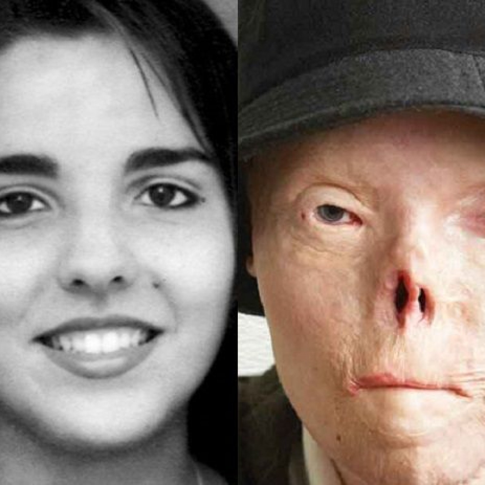 drunk driving victims before and after