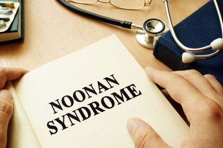 Noonan syndrome Noonan syndrome