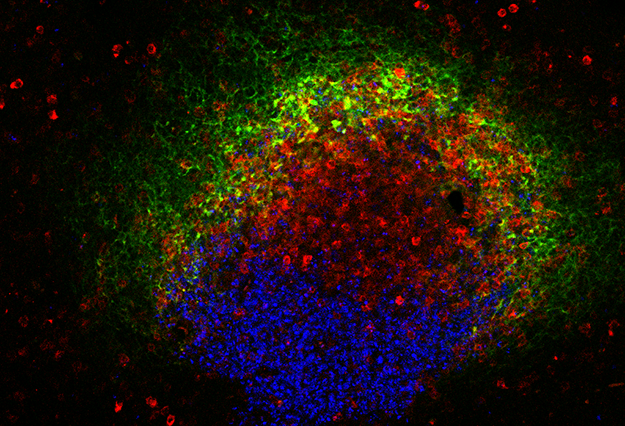 HIV, B cells