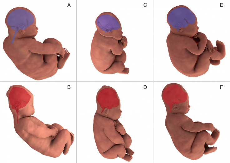baby's head womb baby's head womb