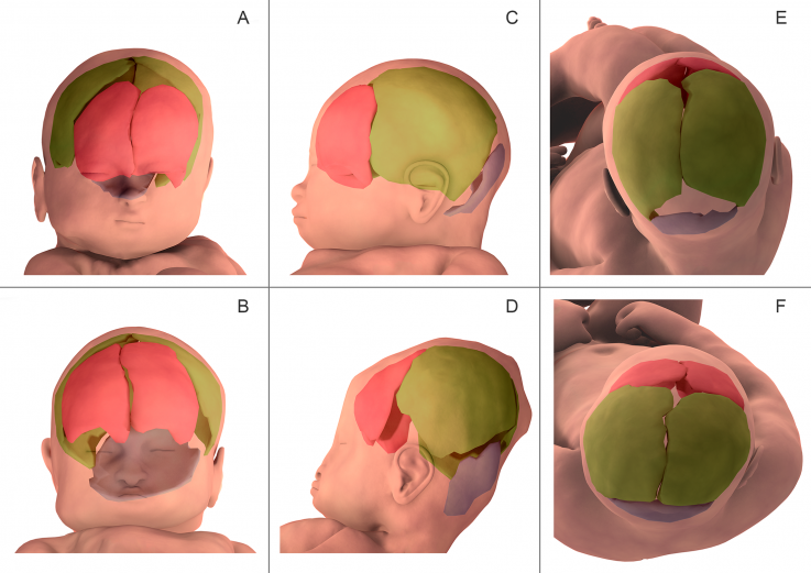 baby head labour plos one baby head labour plos one