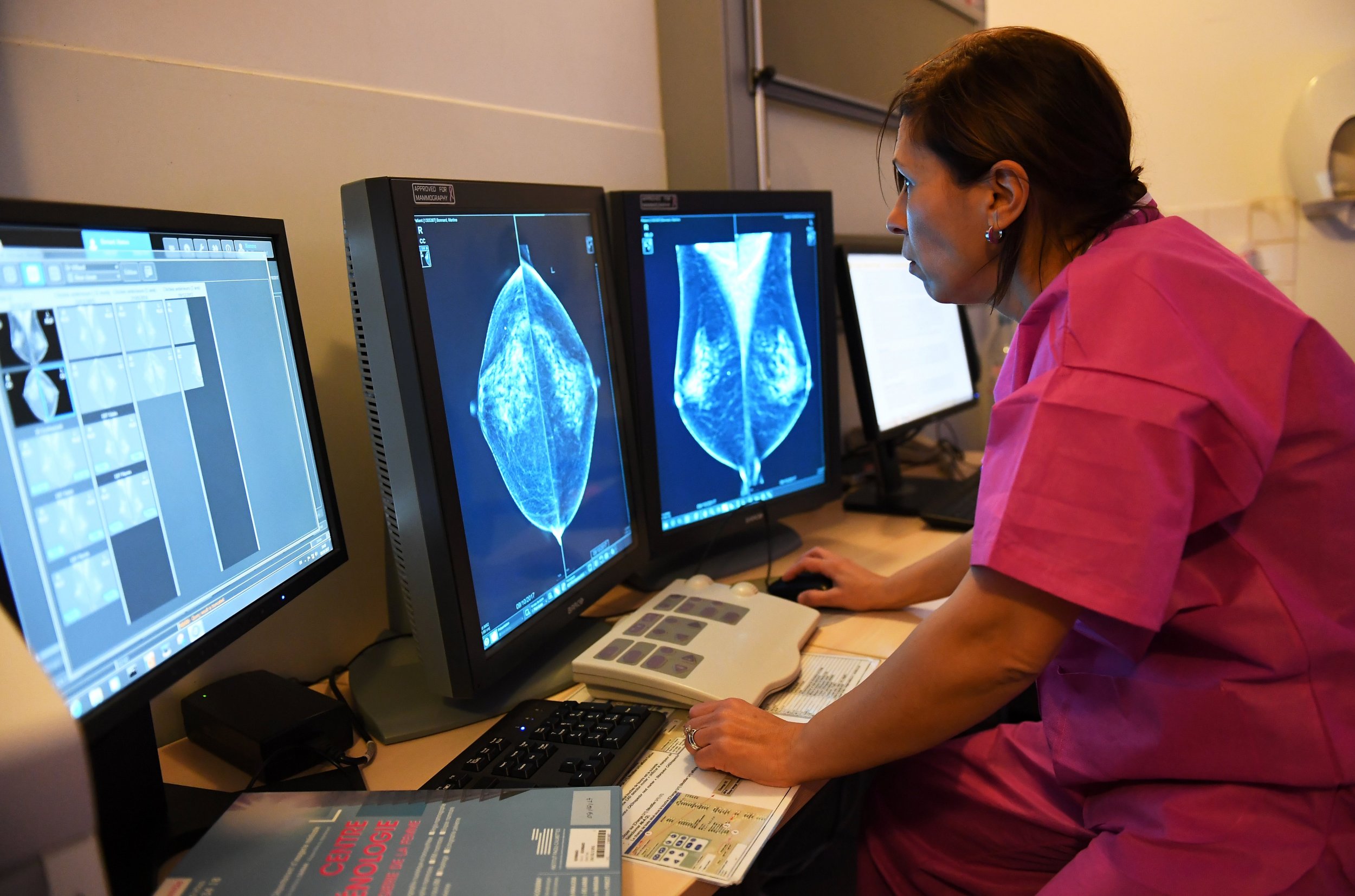 A doctor examines the results of a mammography at the Institute Paoli-Calmettes in France. Experts in the U.S. say physicians need to know more about breast density for breast cancer screening.