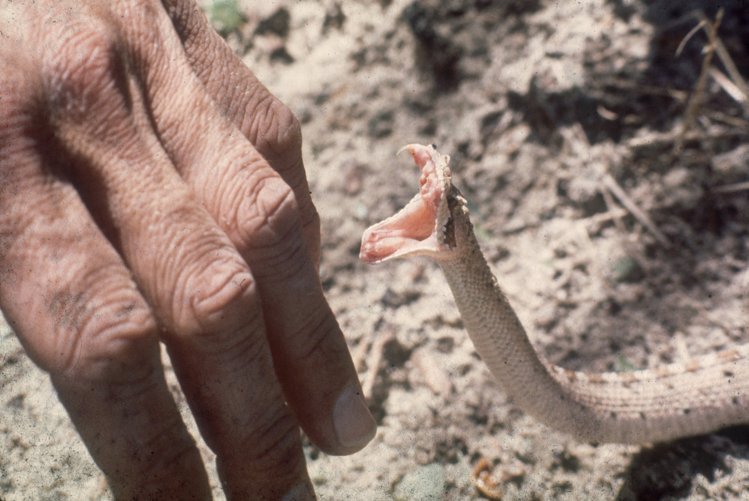 florida-girl-11-bitten-by-venomous-snake-during-camping-trip