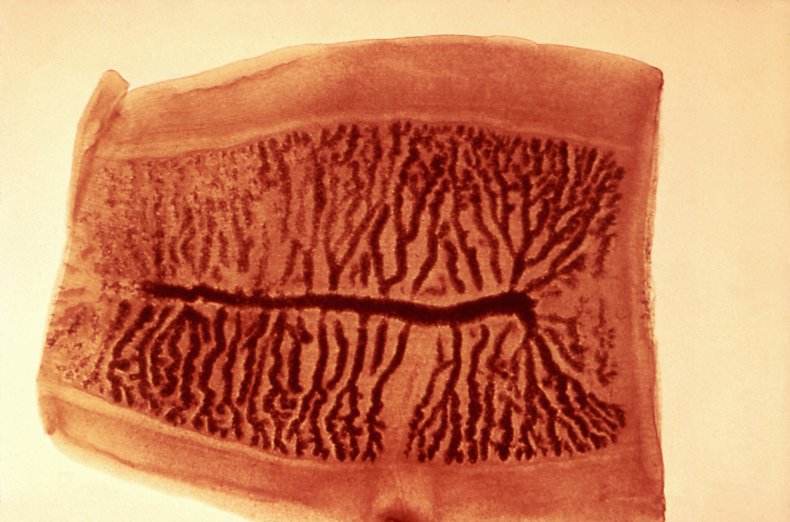 tapeworm parasite