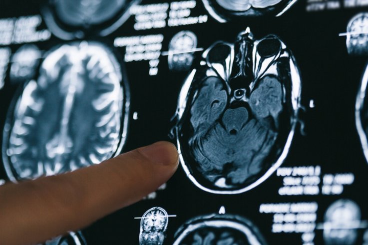 brain scan brain scan
