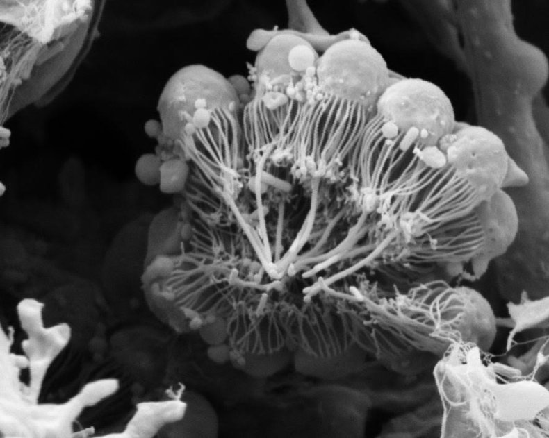 choanocytes
