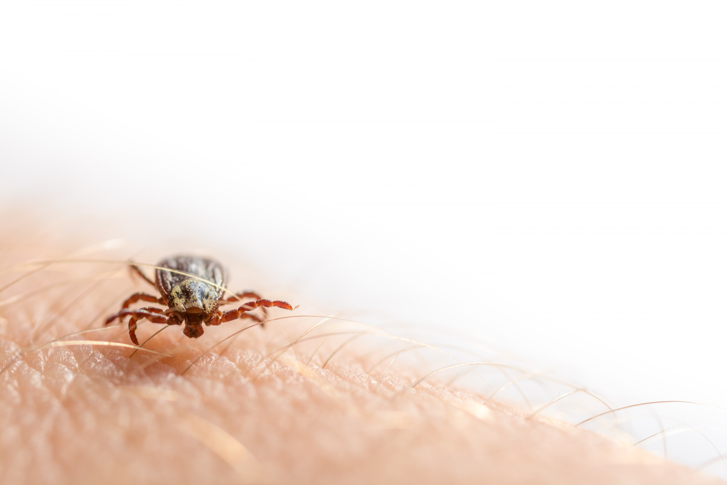 tick diseases