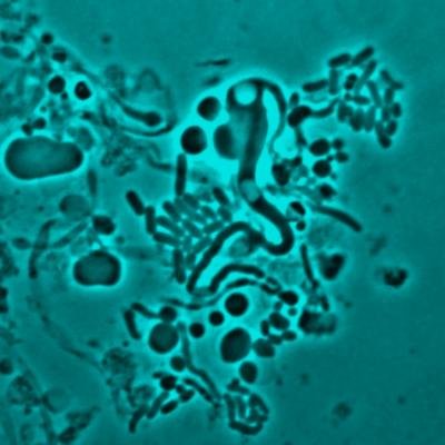 E.coli L-form switching