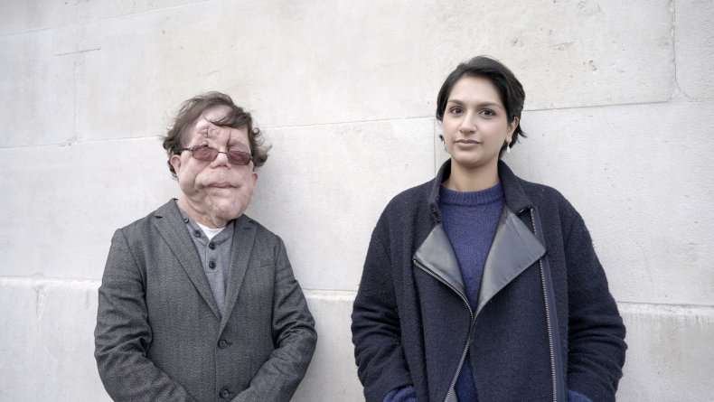 Adam Pearson, bbc four, Angela Saini Science’s Greatest Scandal