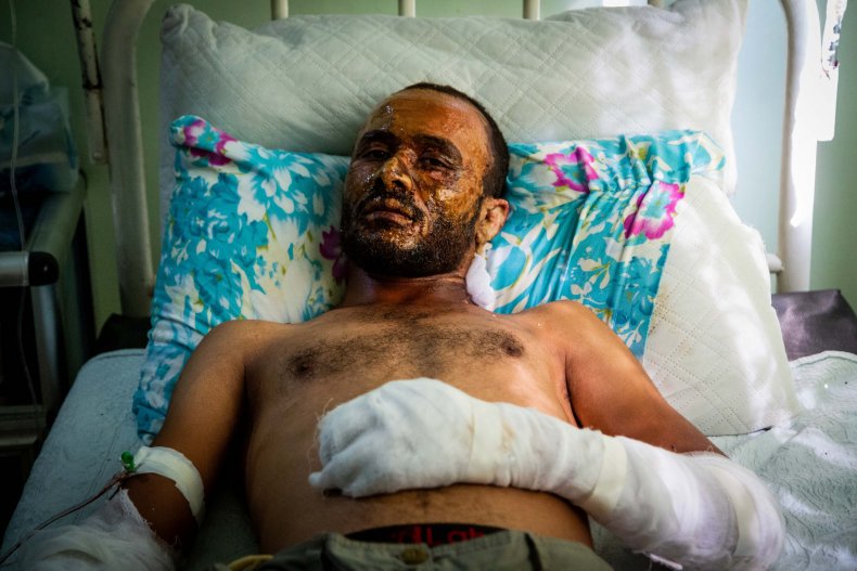 syria war hospital injury