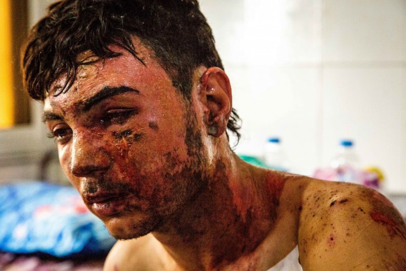 syria man injured hospital war