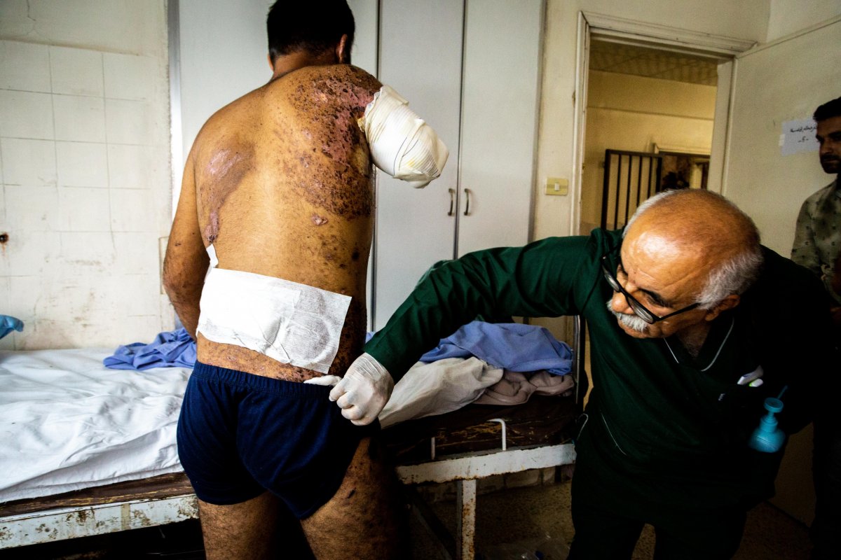 syria injuries war kurds conflict turkey
