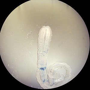 Sparganum