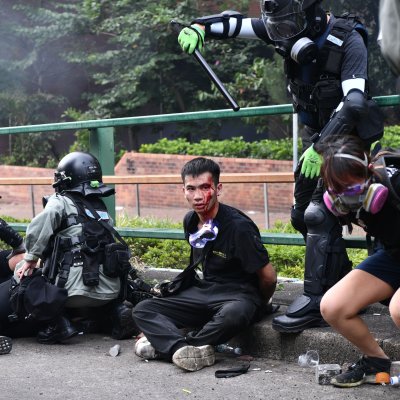 students, arrested, police, polytechnic university, blood, injured students, arrested, police, polytechnic university, blood, injured
