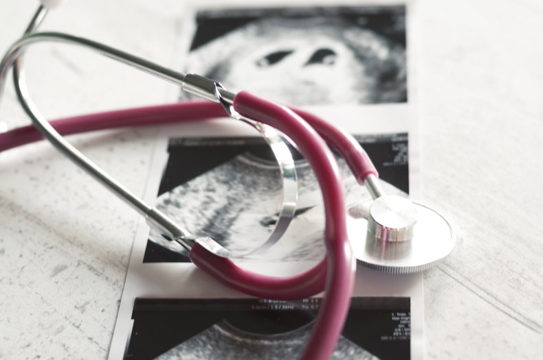A stethoscope over a fetal ultrasound