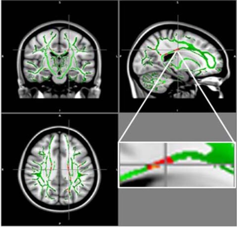 Brain Scans