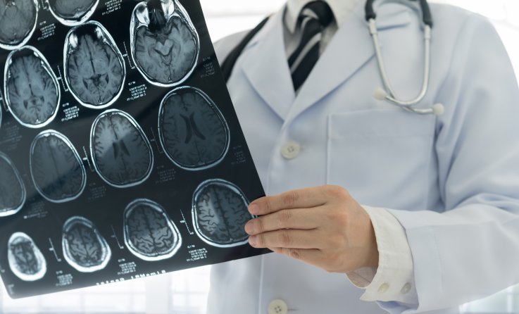 brain scan, stock, getty, xray brain scan, stock, getty, xray