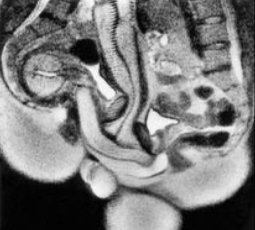 The bmj, sex mri scanner study, The bmj, sex mri scanner study,