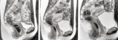 The bmj, sex mri scanner study, The bmj, sex mri scanner study,