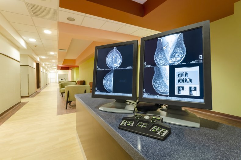 mammogram