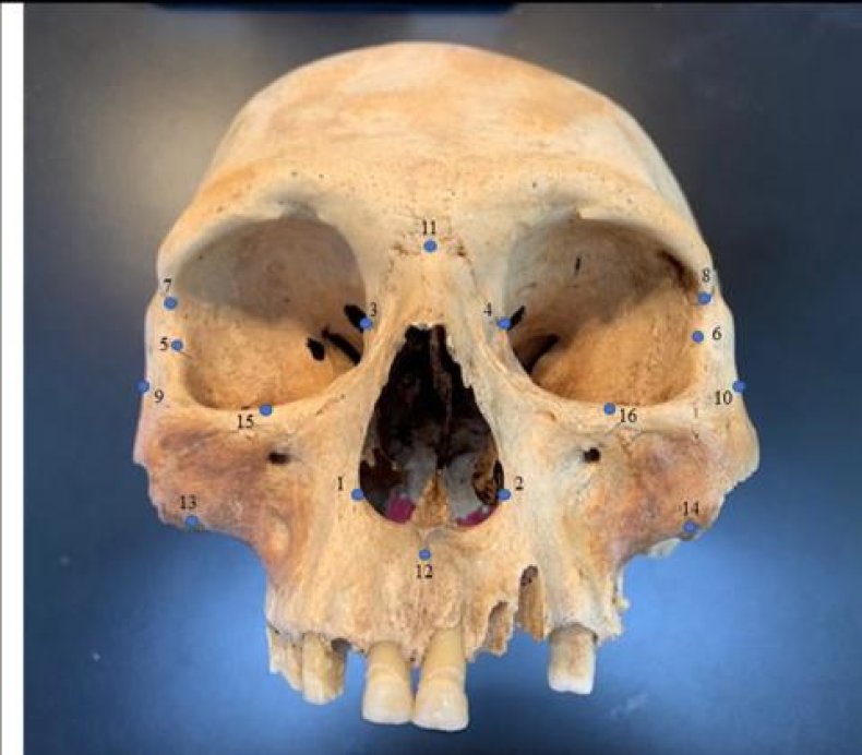 Skull