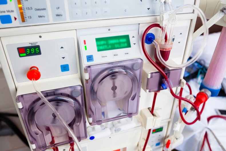 dialysis dialysis