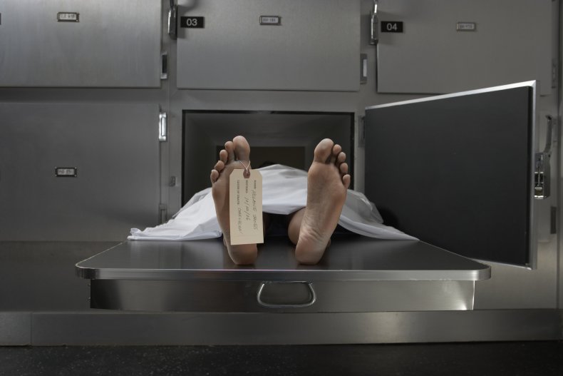 A corpse on a morgue table A corpse on a morgue table