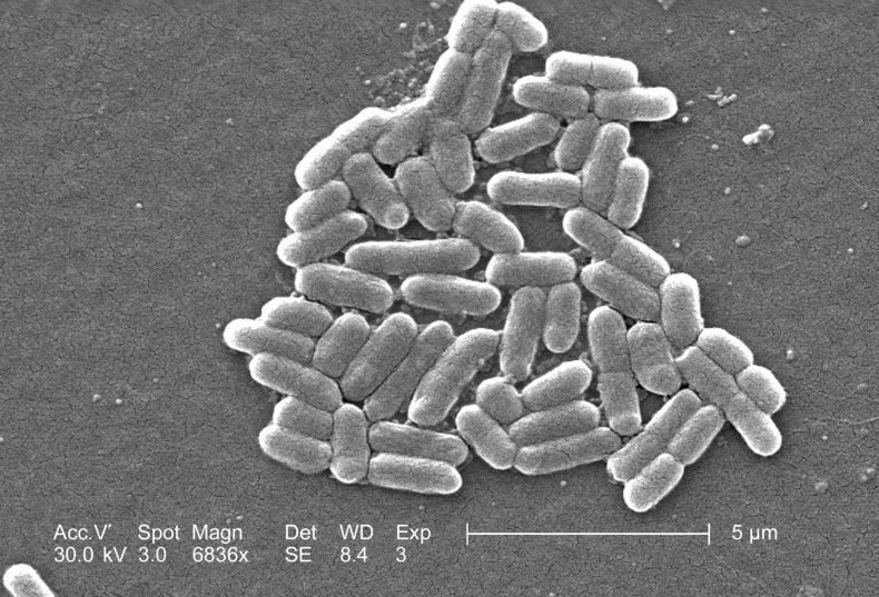 bacteria, e. coli bacteria, e. coli