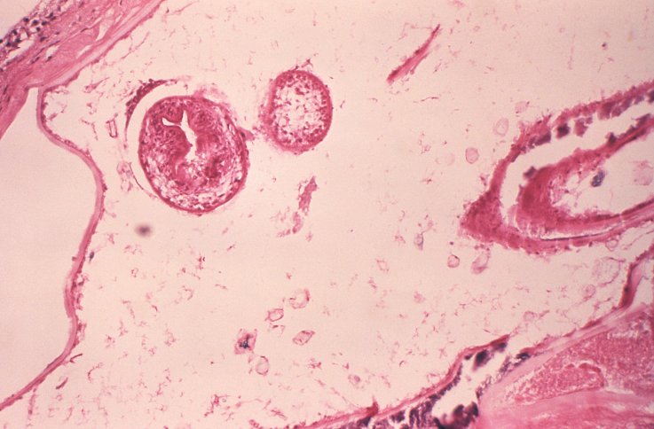 Echinococcus multilocularis Echinococcus multilocularis
