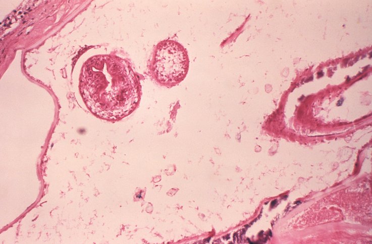 Echinococcus multilocularis