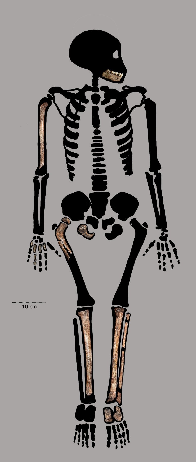 Homo naledi juvenile remains