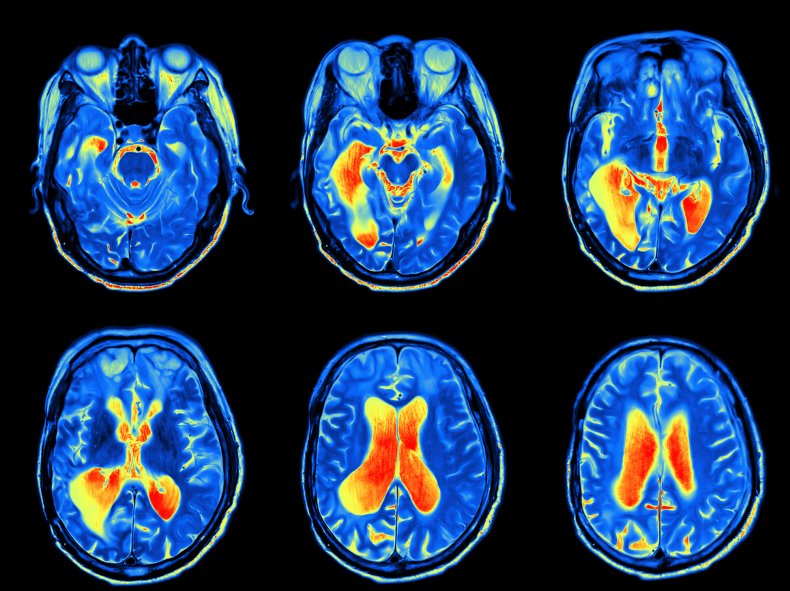 brain, stock, getty